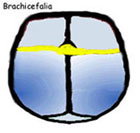 Brachicefalia