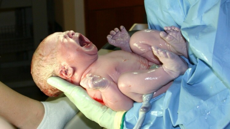 parto-naturale-neonato