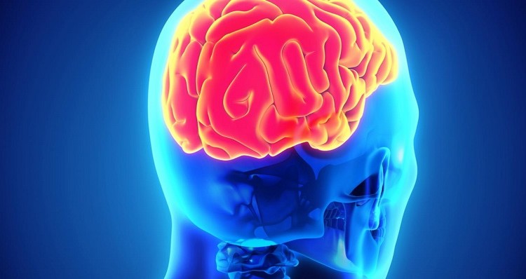 Ipertensione endocranica occulta come sequela della stenosi giugulare di origine biomeccanica: case report