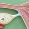 ENDOMETRIOSI E DOLORE PELVICO MIOFASCIALE