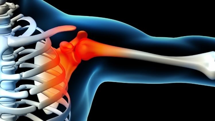 Diagnosi differenziale e trattamento osteopatico nelle algie del cingolo scapolare