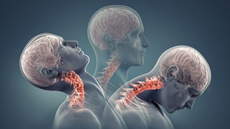 Colpo di frusta, cosa succede a livello dei tessuti?
